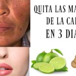 3 trucos fáciles para quitar manchas de la cara en 3 días