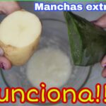 Cómo quitar las manchas de la cara rápido