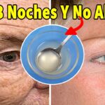 5 Remedios Caseros para Reducir Arrugas en la Cara 5 Remedios Caseros para Reducir Arrugas en la Cara