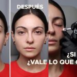 Beneficios del ácido hialurónico en la piel joven: ¿Realmente funciona?
