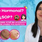 Descubre si tu acné es hormonal con estos sencillos pasos