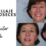 Trucos de maquillaje para ocultar rojeces: ¡lucí un cutis perfecto!