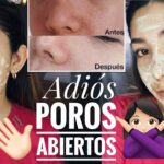 5 mascarillas efectivas para cerrar tus poros - ¡Prueba ahora! 5 mascarillas efectivas para cerrar tus poros – ¡Prueba ahora!