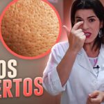 Elimina poros abiertos con estos trucos de belleza
