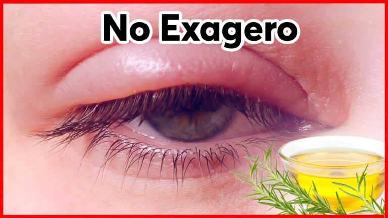 5 trucos efectivos para deshinchar los ojos después de llorar