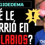 Cómo tratar labios hinchados por el sol de forma efectiva