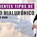 Consejos para comprar ácido hialurónico para labios: ¡Luce irresistibles! Consejos para comprar ácido hialurónico para labios: ¡Luce irresistibles!