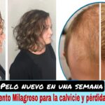 Consejos efectivos para estimular el crecimiento del cabello Consejos efectivos para estimular el crecimiento del cabello