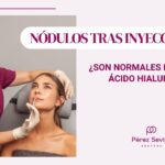 Elimina las bolitas del ácido hialurónico con estos consejos