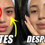 Elimina tus ojeras en 5 pasos: guía para mujeres