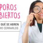 Por qué se abren los poros de la cara y cómo evitarlo