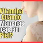 Vitamina deficiente causante de manchas en la piel: descúbrelo ahora