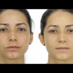 5 formas naturales para ocultar manchas en la piel
