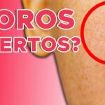 5 trucos efectivos para cerrar los poros de la piel del rostro