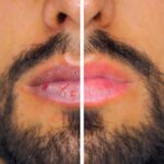 10 trucos para hidratar tus labios resecos y agrietados