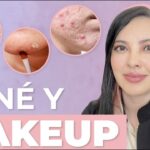 Maquillaje para acné: opciones efectivas en farmacias cercanas Maquillaje para acné: opciones efectivas en farmacias cercanas