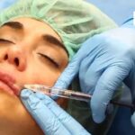 Labios irresistibles con ácido hialurónico: todo lo que necesitas saber Labios irresistibles con ácido hialurónico: todo lo que necesitas saber