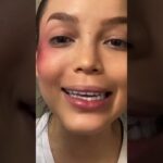 Maquillaje para ojo morado: cómo ocultarlo con estilo